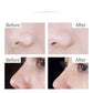 Glycolic & Fruit Acid Essence – 30ml Serum (10PCS)