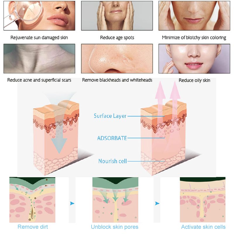 3-in-1 HydroDermabrasion Spa System — Deep Cleanse & Hydrate - image 11